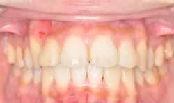 予防歯科8