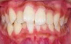 小児歯科3